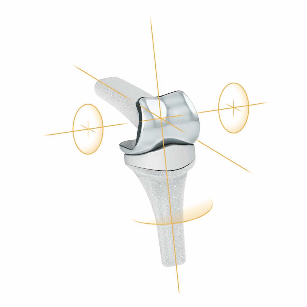 Orb Medical | Proximal Interphalangeal Replacement™