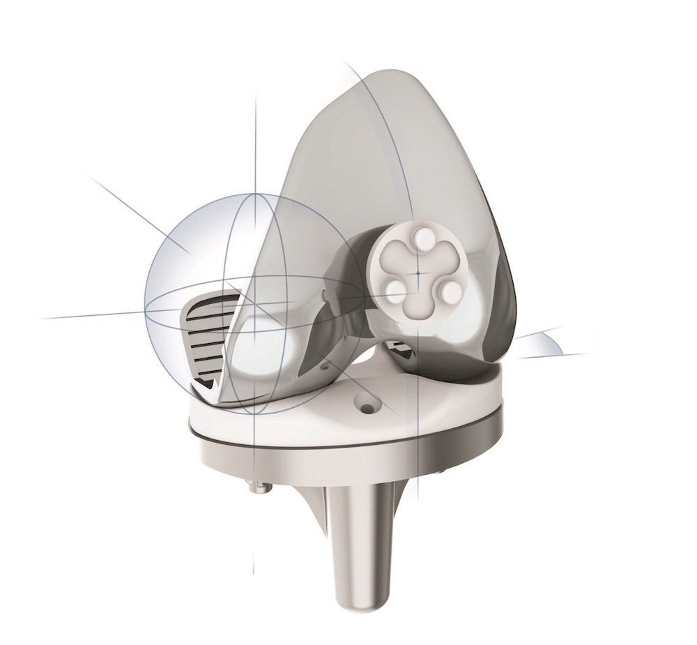 Orb Medical | SAIPH® Knee System