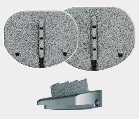 Orb Medical | Prodisc L