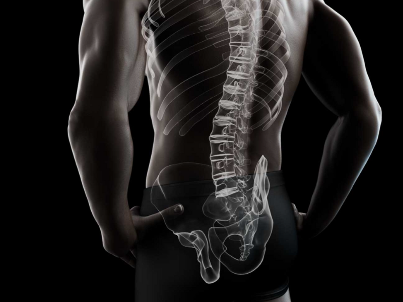 Orb Medical | icotec Pedicle Systems