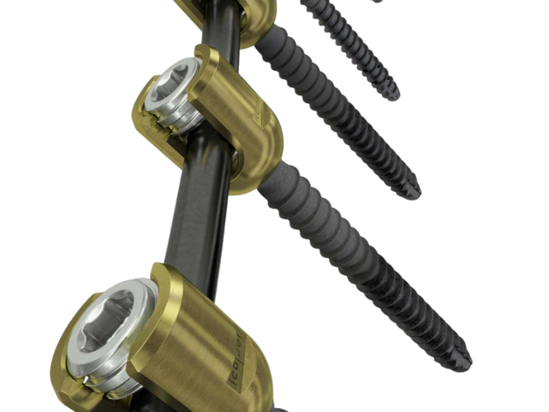 Orb Medical | icotec Pedicle Systems