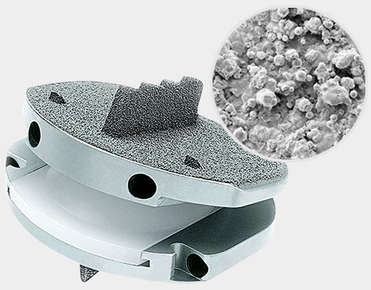 Orb Medical | Prodisc L