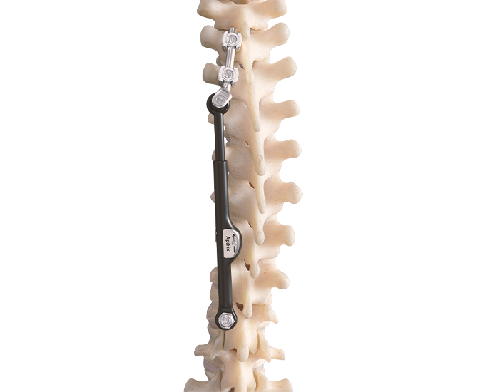 Orb Medical | OrthoPediatrics Spine