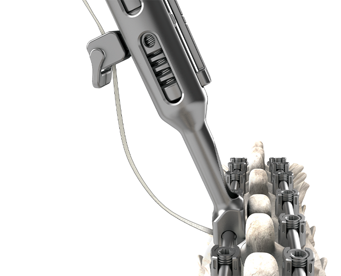 Orb Medical | OrthoPediatrics Spine